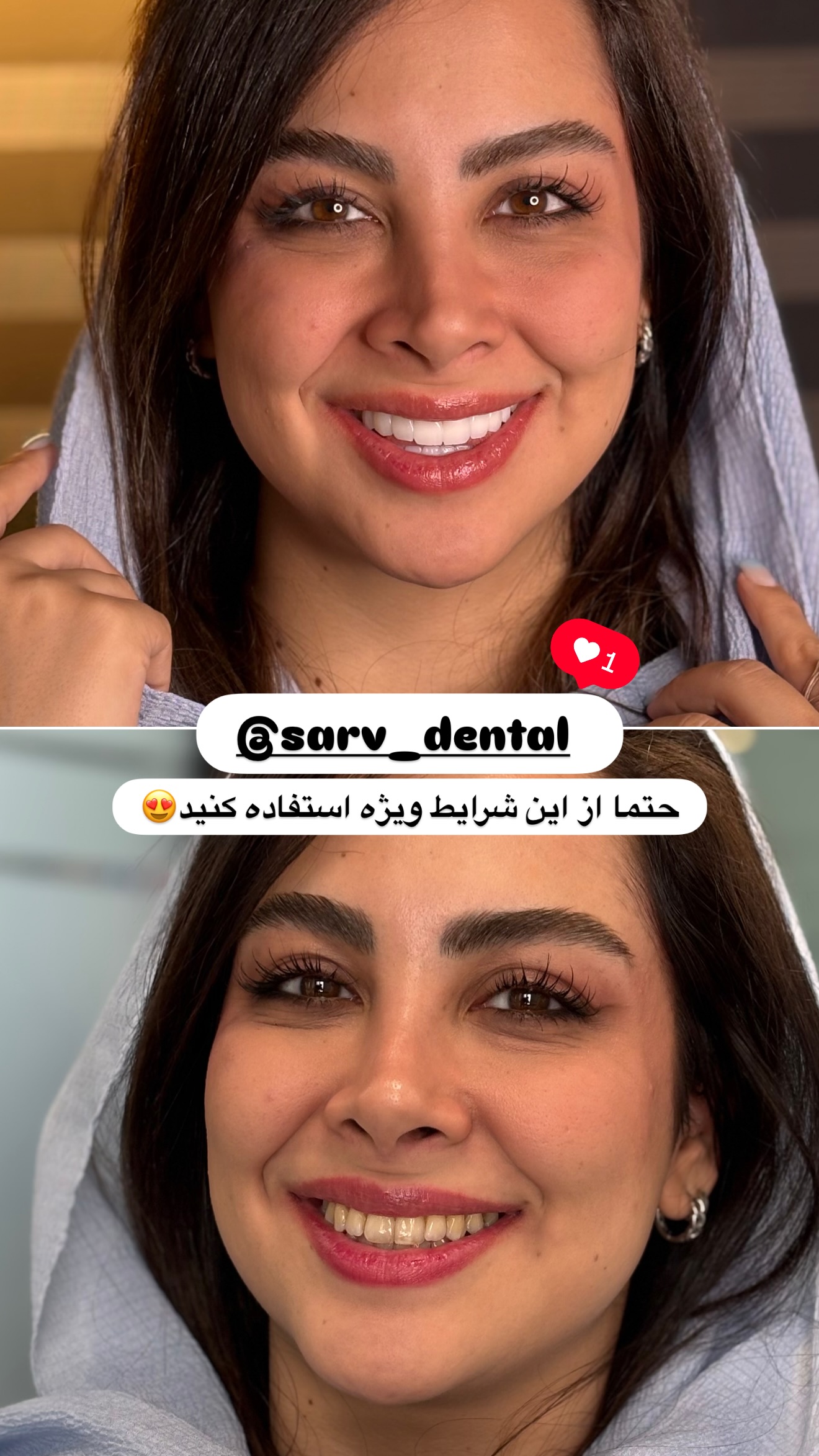  جدید ترین استوری اینستاگرام مائده