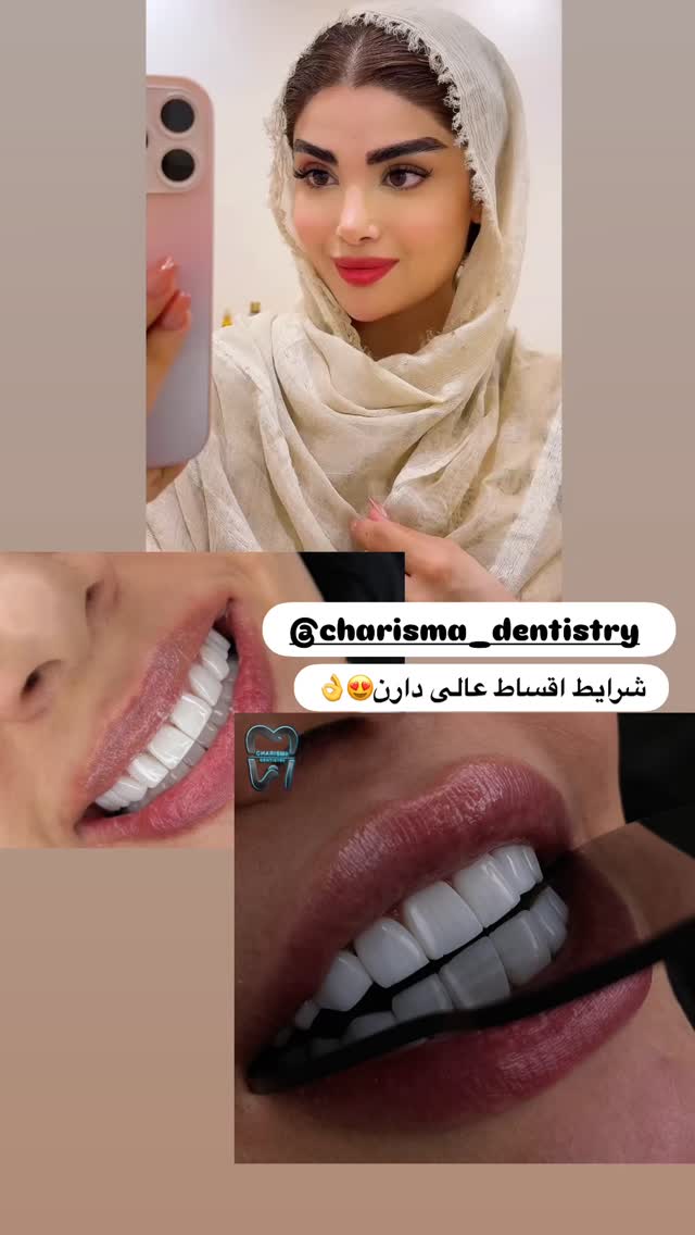  جدید ترین استوری اینستاگرام مائده