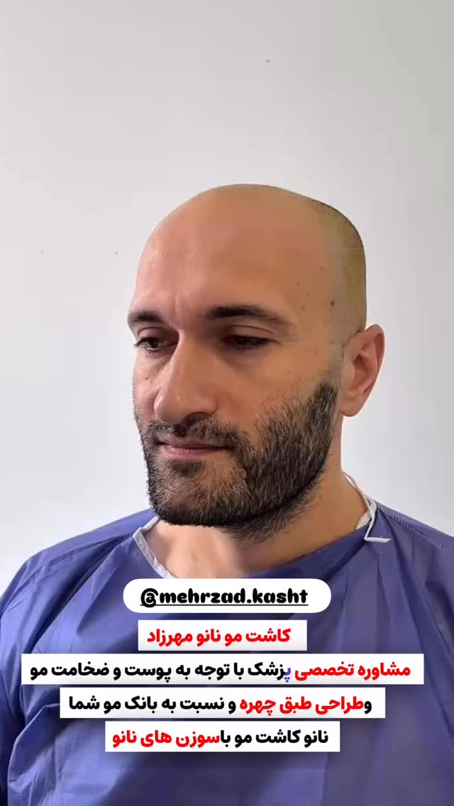  جدید ترین استوری اینستاگرام مائده