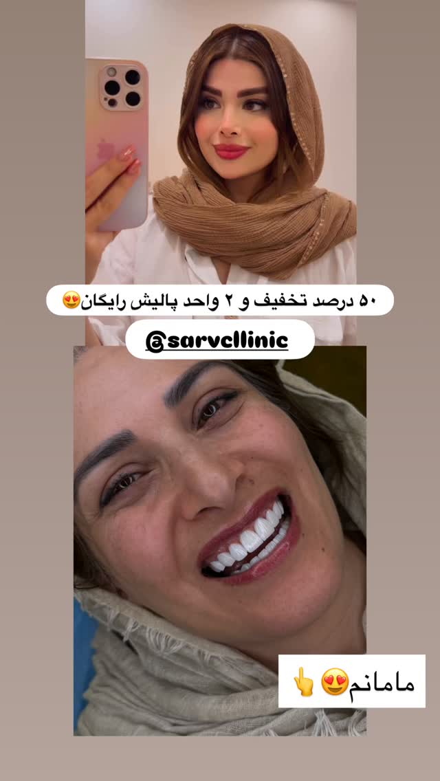  جدید ترین استوری اینستاگرام مائده