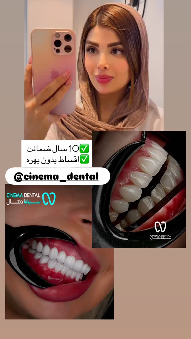  جدید ترین استوری اینستاگرام مائده