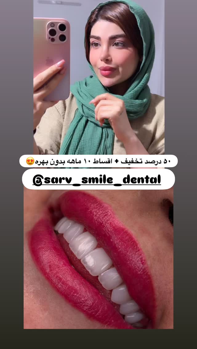  جدید ترین استوری اینستاگرام مائده