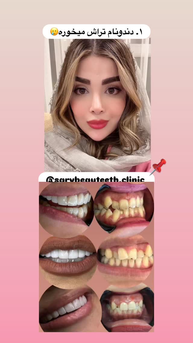 جدید ترین استوری اینستاگرام مائده