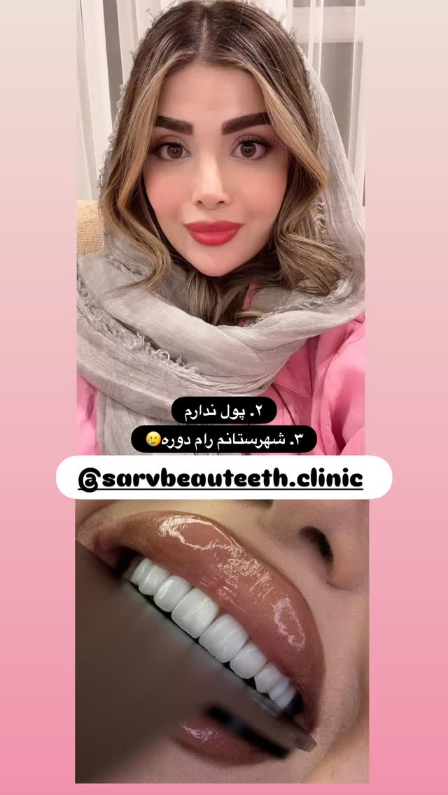  جدید ترین استوری اینستاگرام مائده