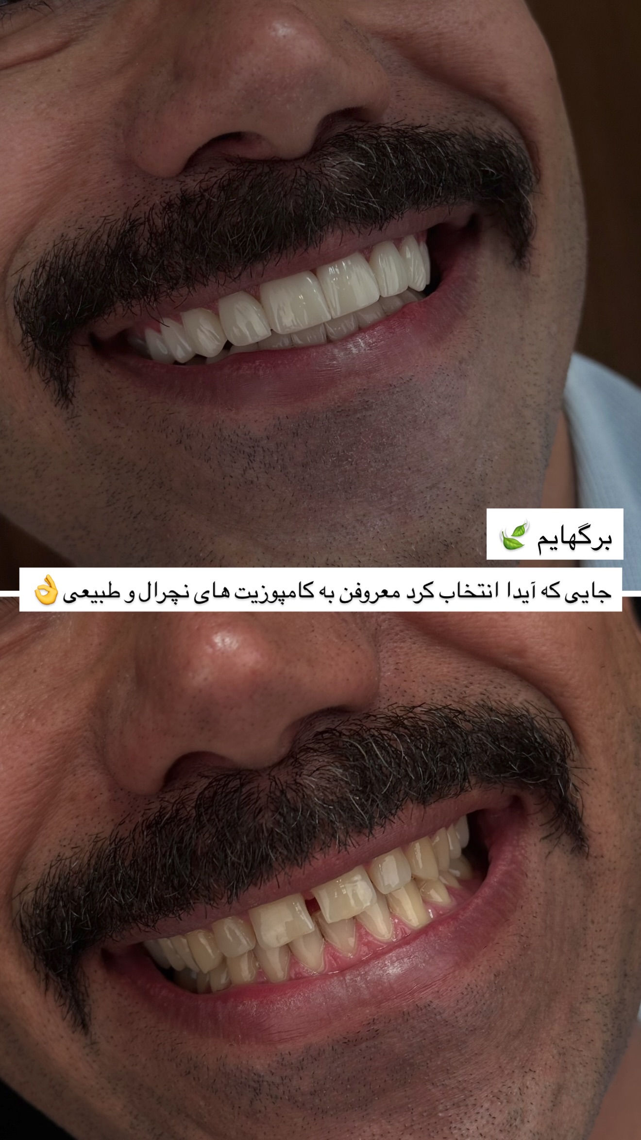  جدید ترین استوری اینستاگرام مائده
