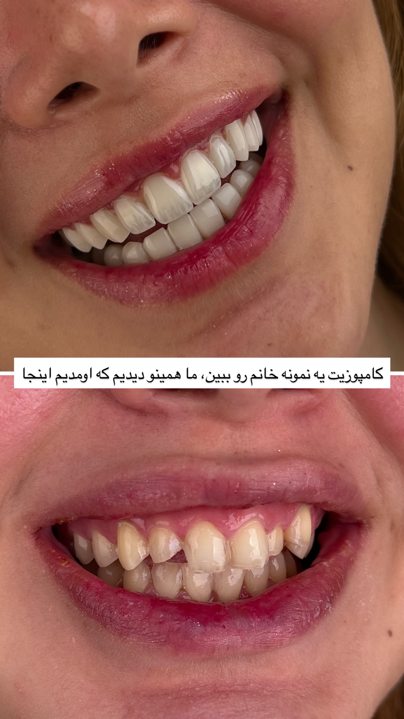  جدید ترین استوری اینستاگرام مائده