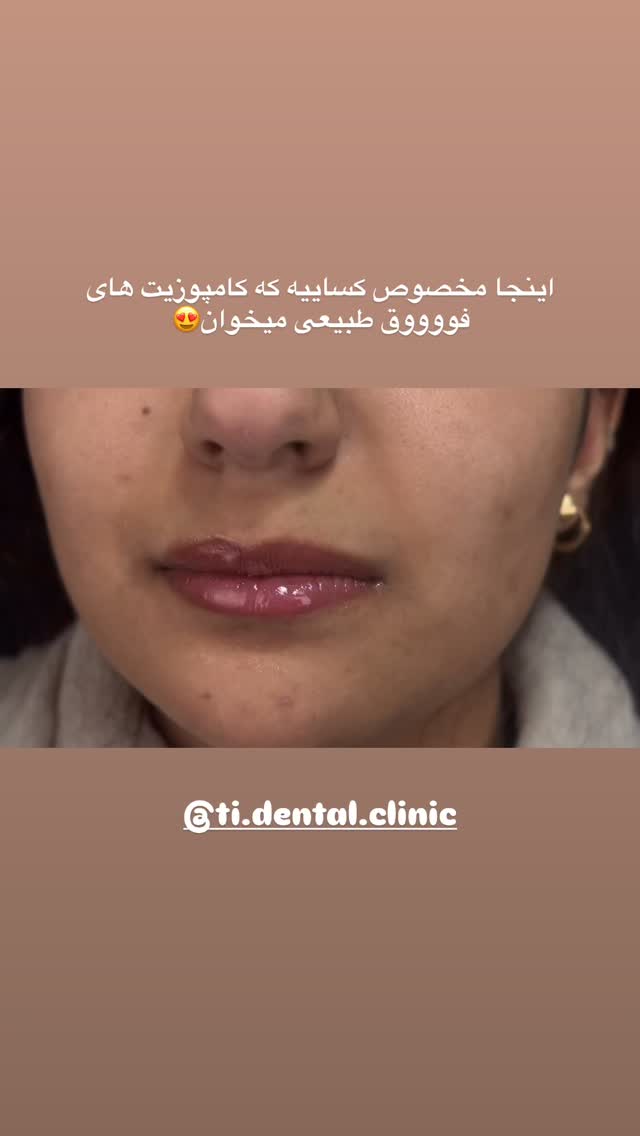  جدید ترین استوری اینستاگرام مائده