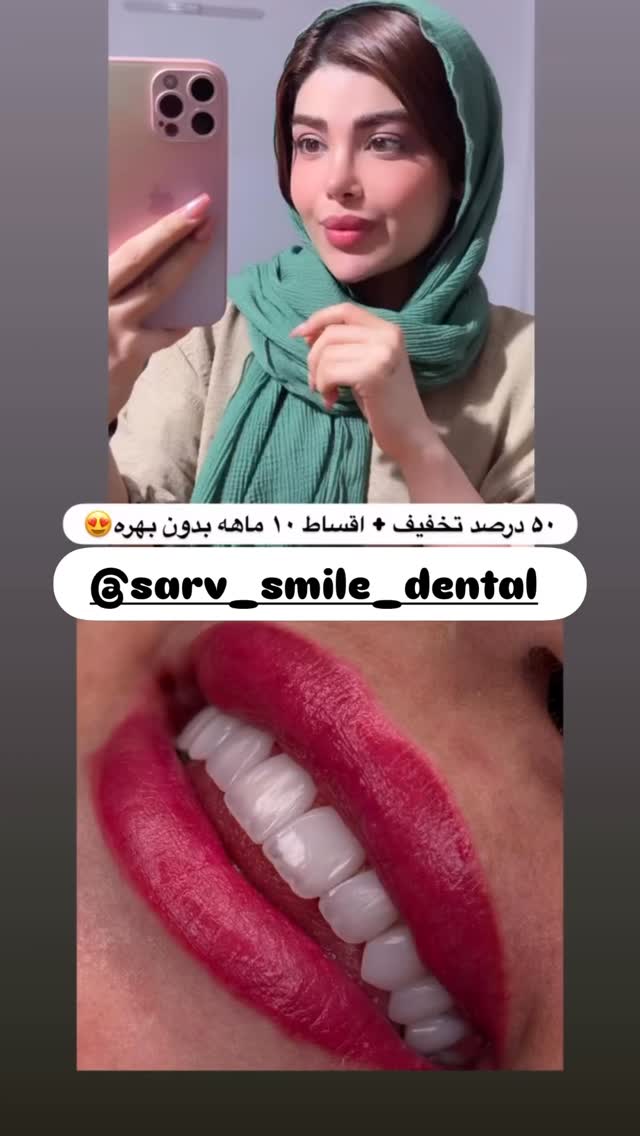  جدید ترین استوری اینستاگرام مائده