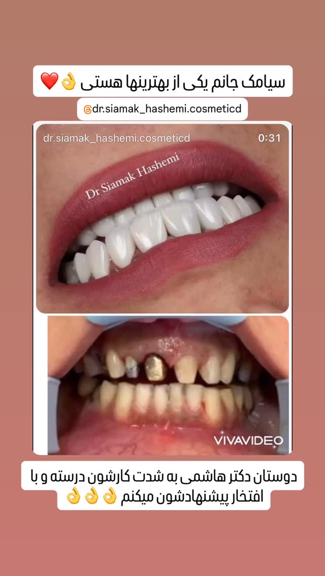  جدید ترین استوری اینستاگرام مهدی سالک
