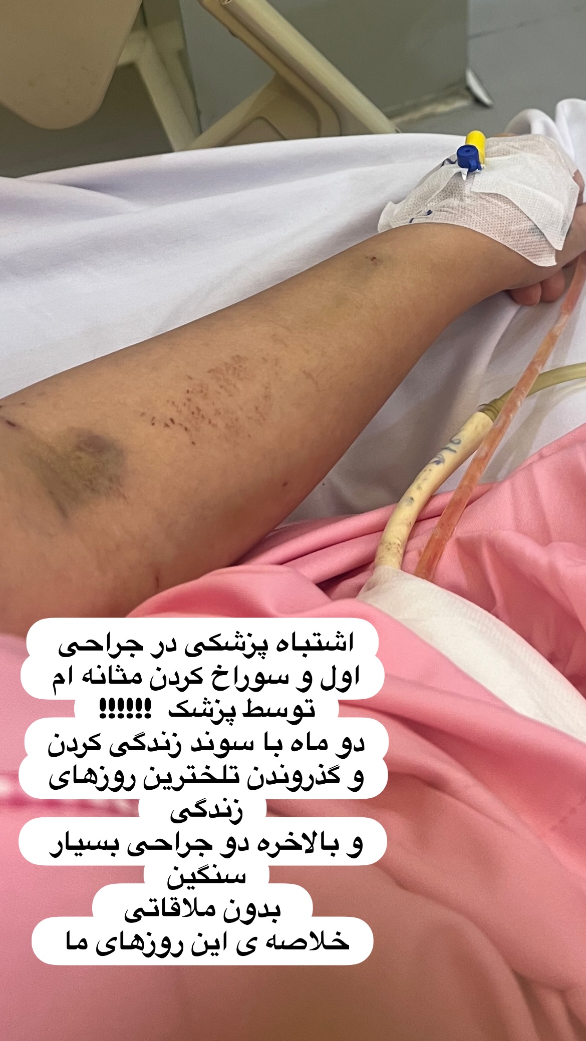  جدید ترین استوری اینستاگرام مهرناز دبیز زاده