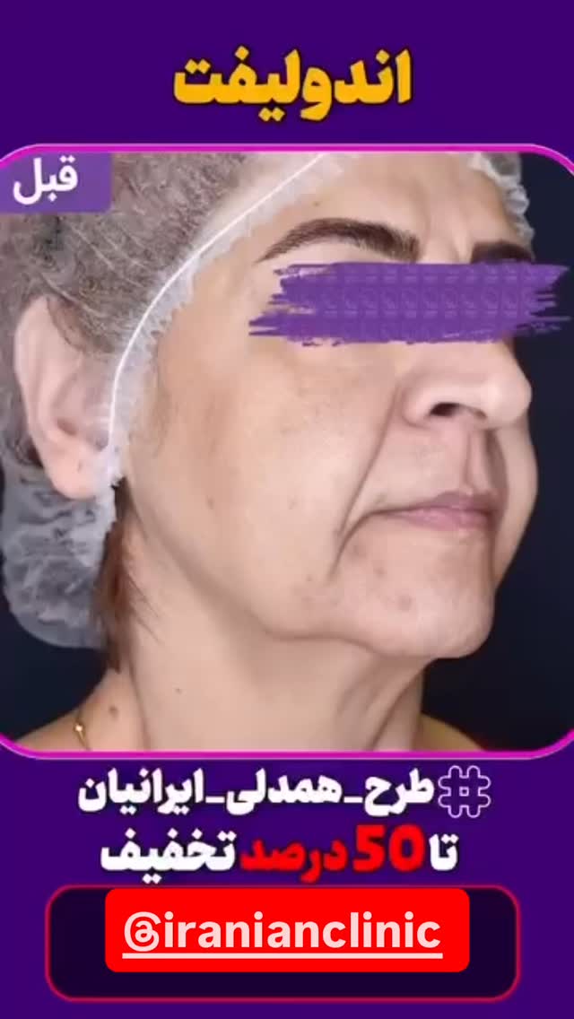  جدید ترین استوری اینستاگرام مهرسا سامی
