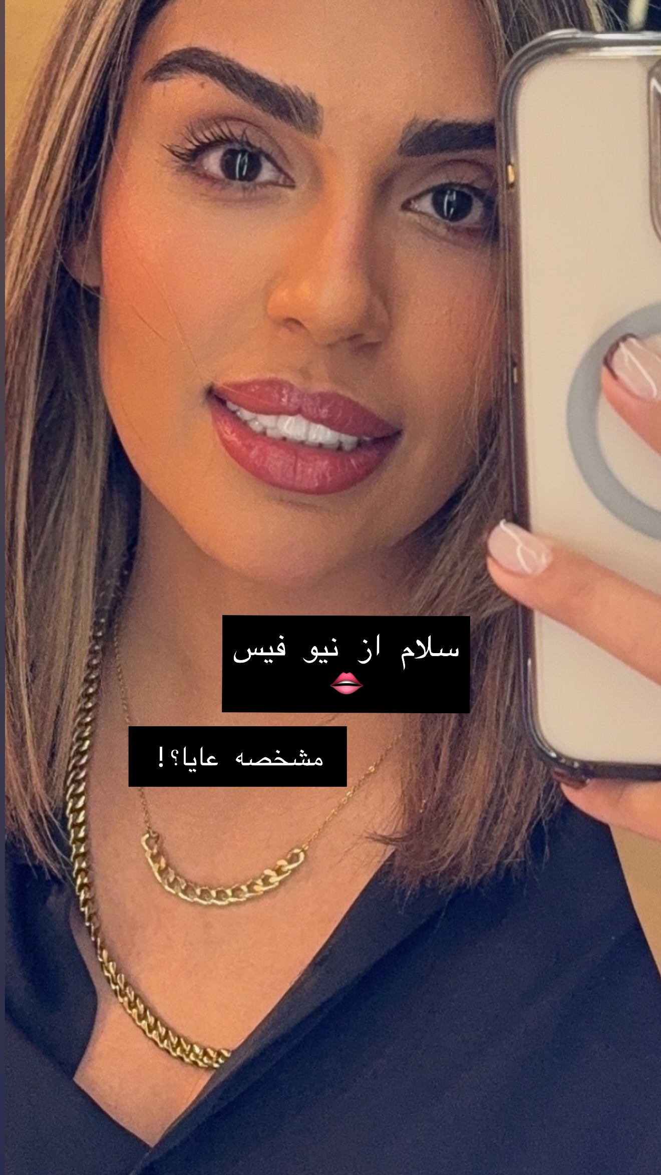  جدید ترین استوری اینستاگرام مهرشاد گل مکانیان