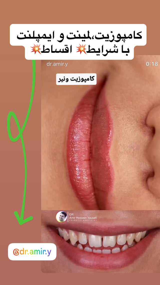  جدید ترین استوری اینستاگرام زهرا صفاریان