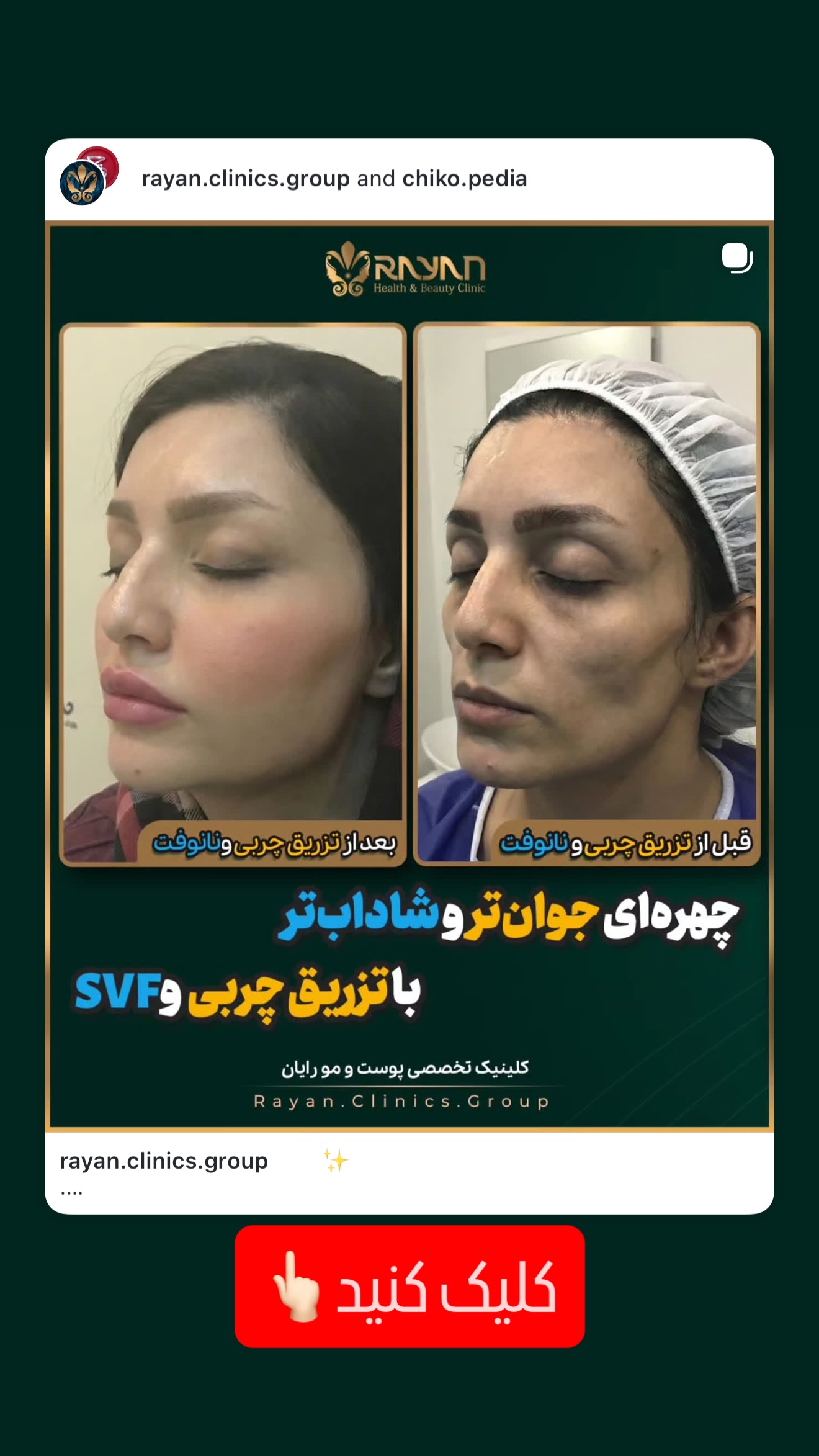  جدید ترین استوری اینستاگرام میلاد قاسمی خواه