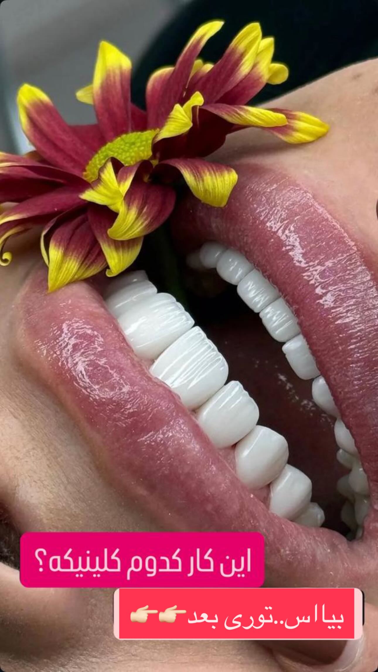  جدید ترین استوری اینستاگرام مینا حسن زاده