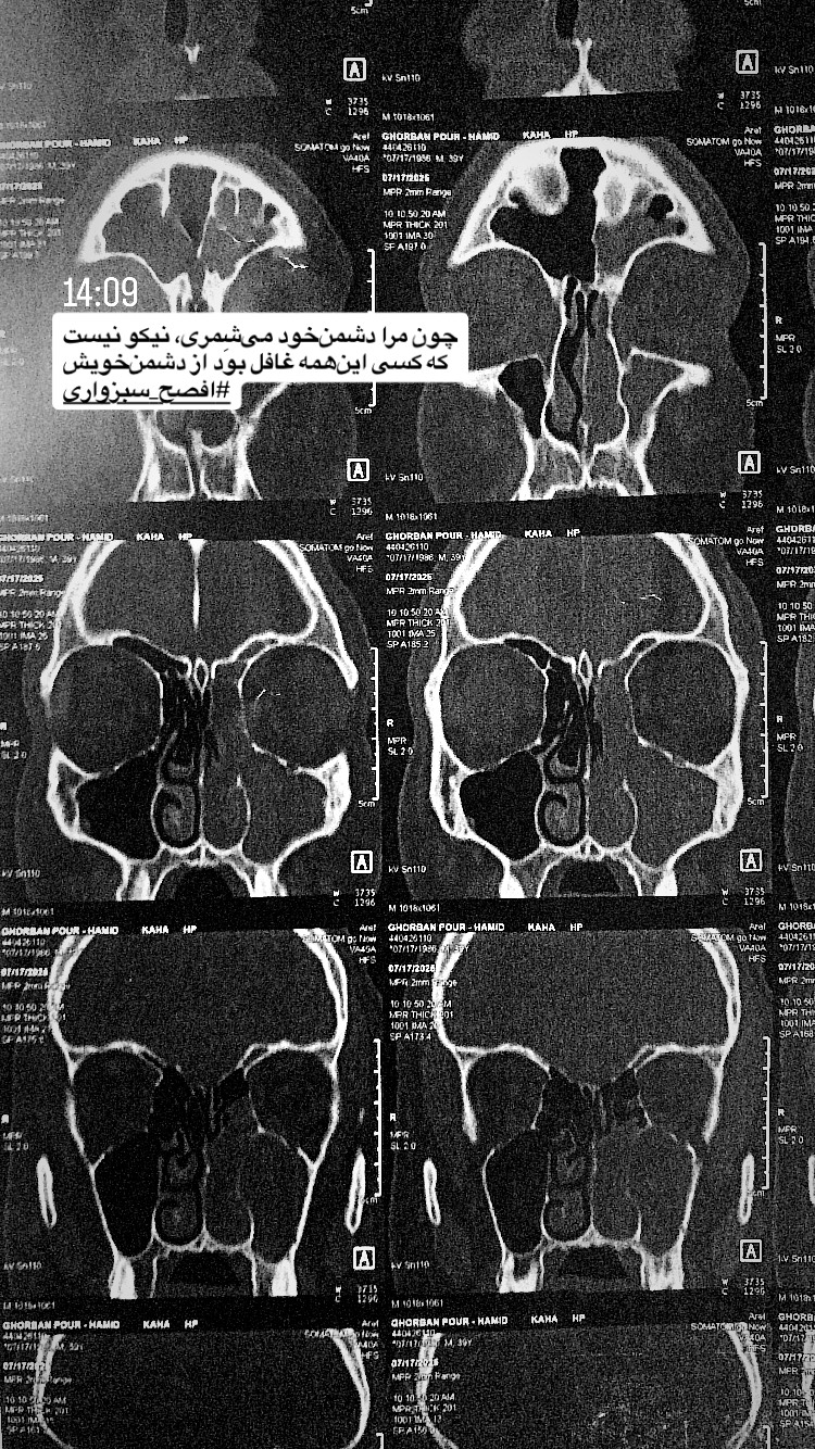  جدید ترین استوری اینستاگرام حمید قربانپور
