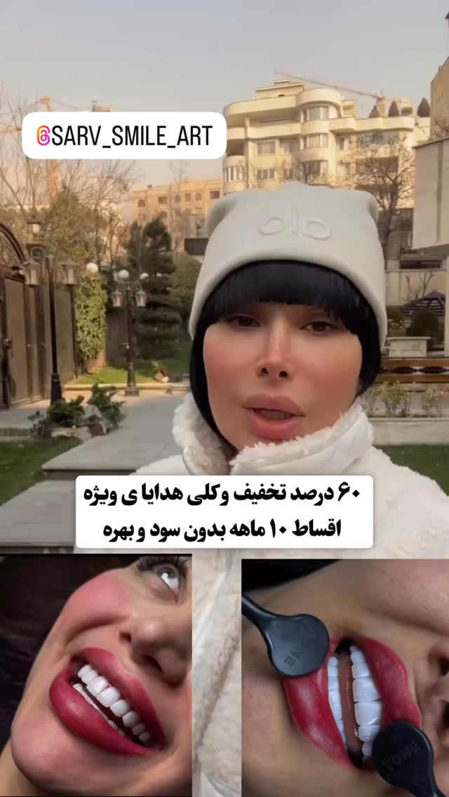  جدید ترین استوری اینستاگرام میس نانا