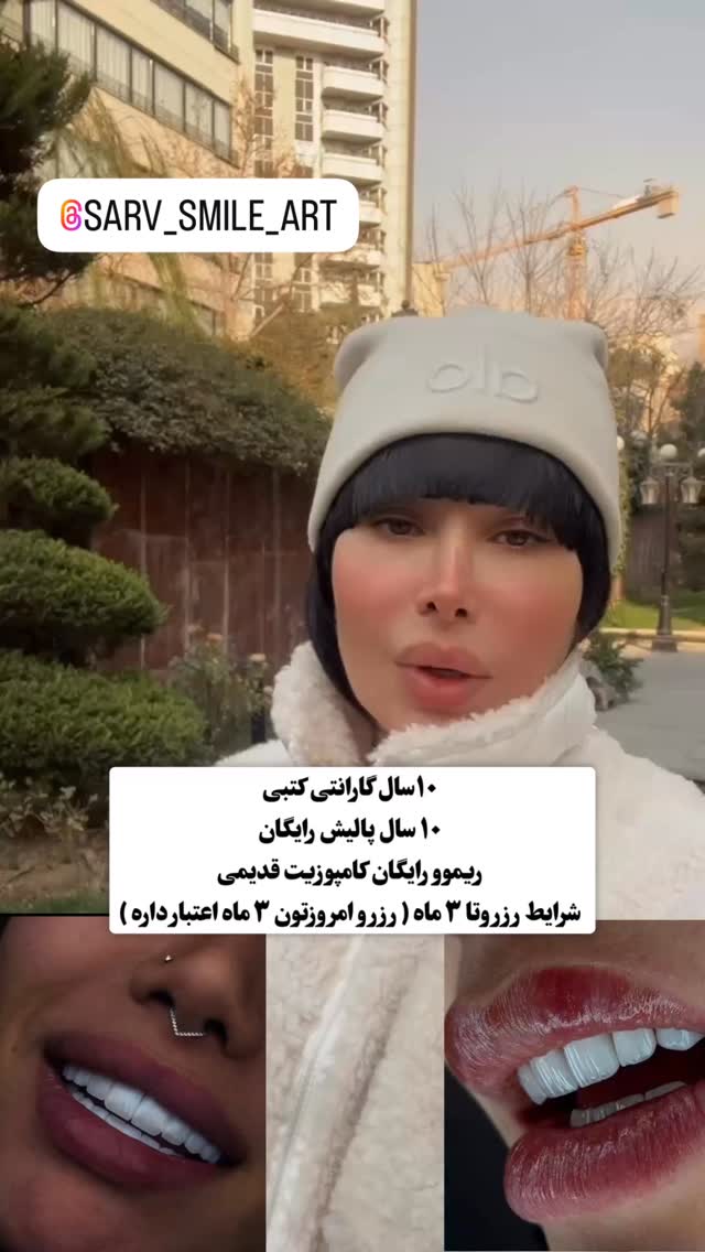  جدید ترین استوری اینستاگرام میس نانا