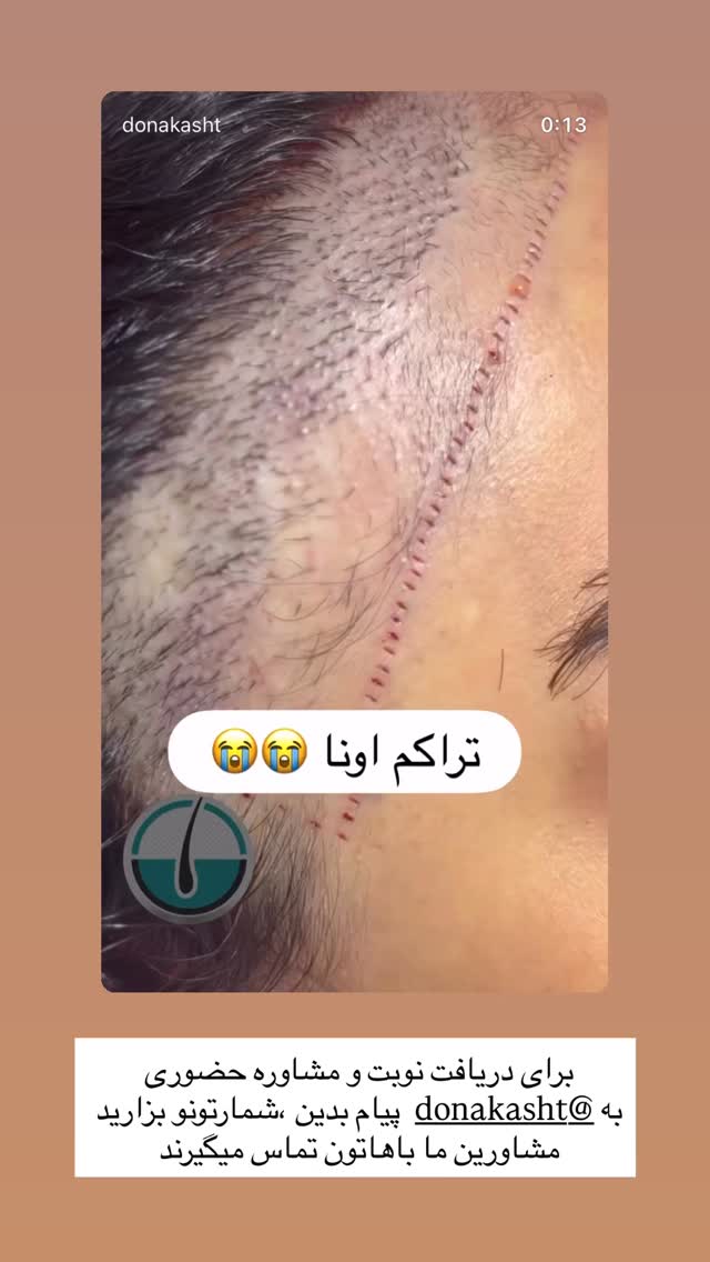  جدید ترین استوری اینستاگرام میترا یوسفی