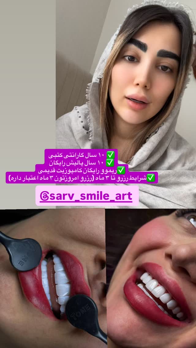  جدید ترین استوری اینستاگرام مبینا