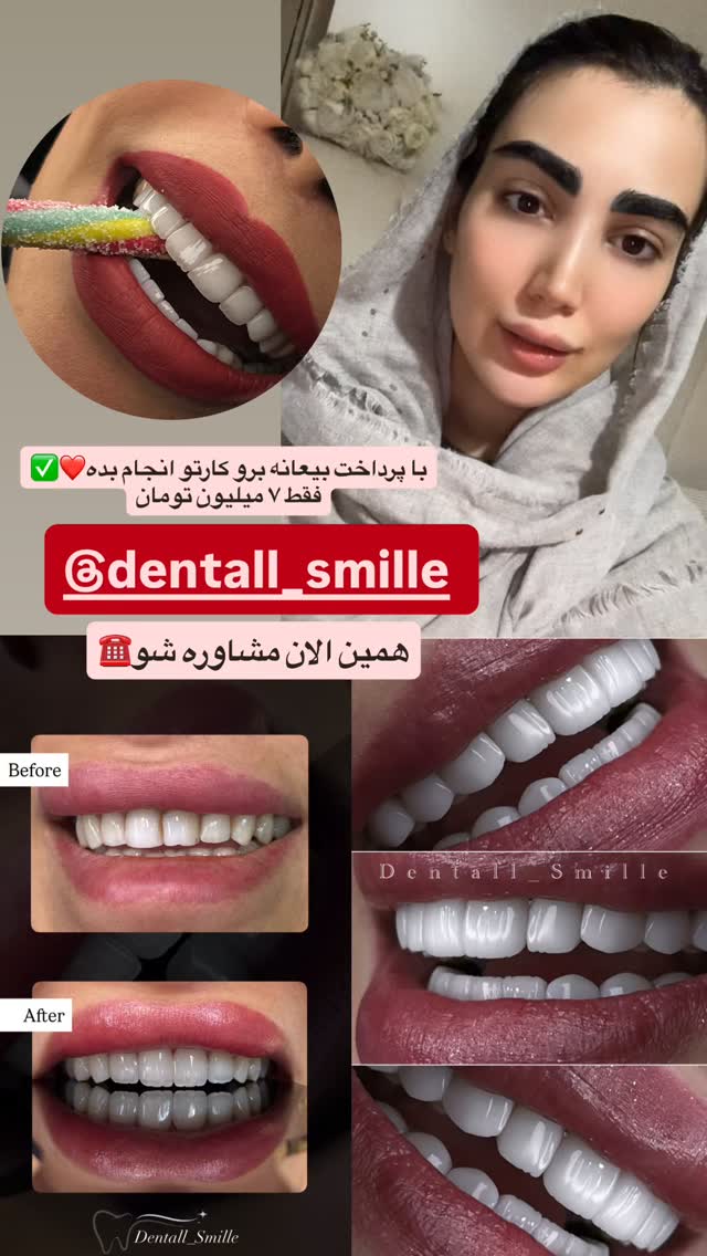  جدید ترین استوری اینستاگرام مبینا