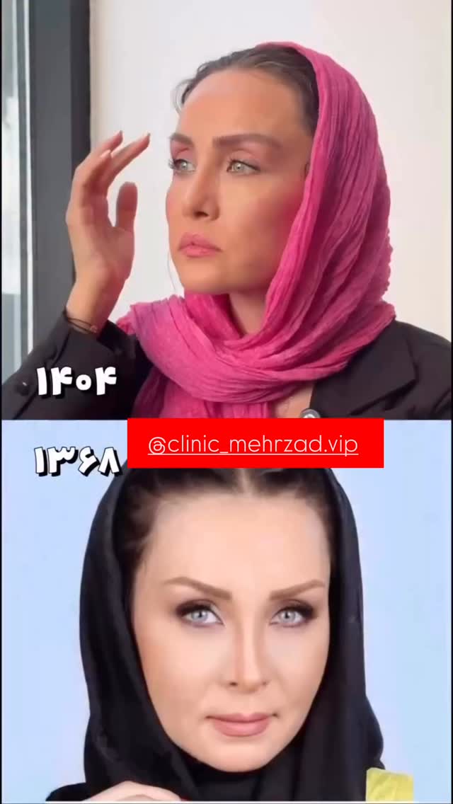  جدید ترین استوری اینستاگرام محمد امین کرم پور
