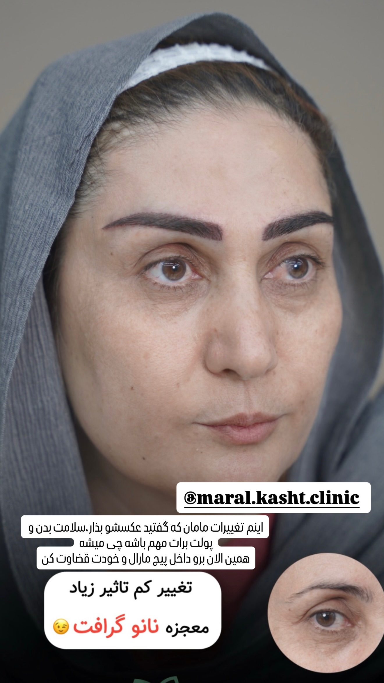 جدید ترین استوری اینستاگرام محمد خاک باز