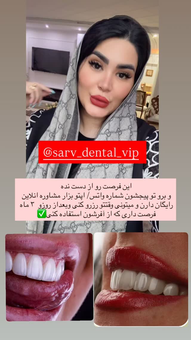  جدید ترین استوری اینستاگرام محی