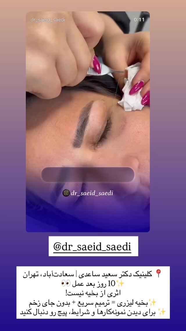  جدید ترین استوری اینستاگرام محی