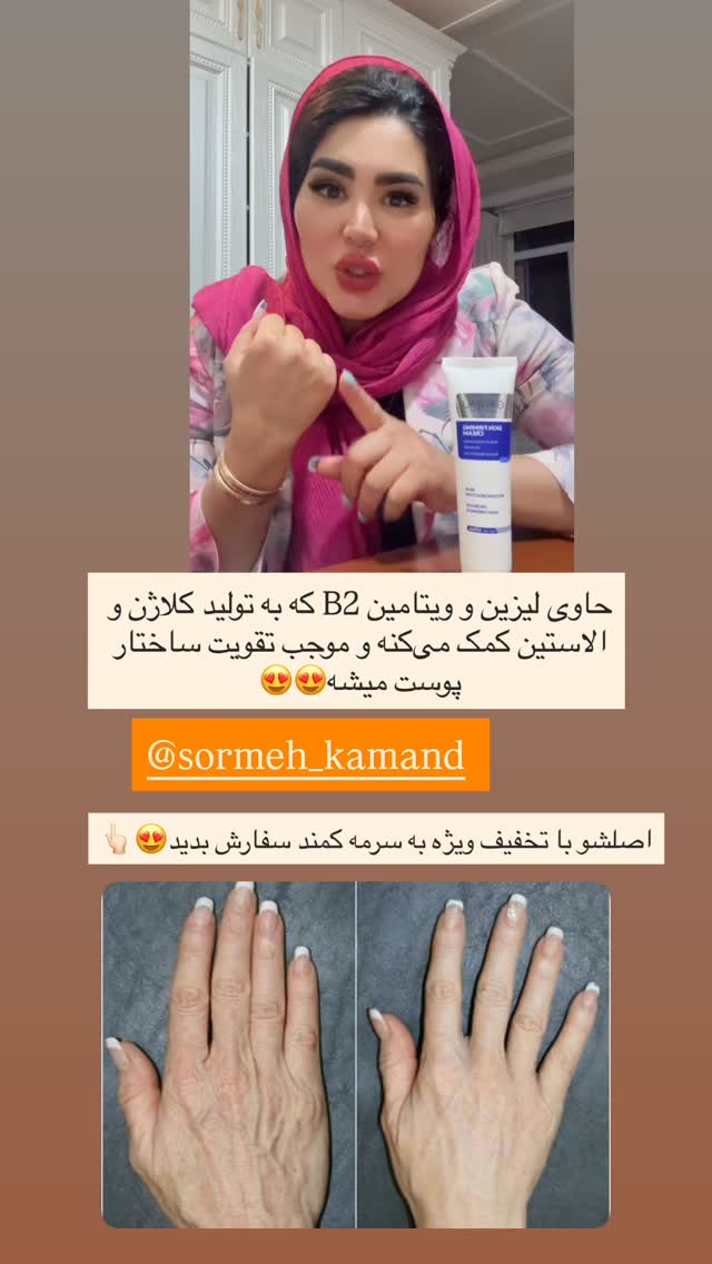  جدید ترین استوری اینستاگرام محی