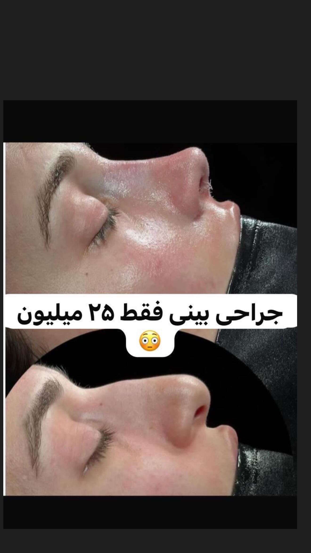  جدید ترین استوری اینستاگرام محی
