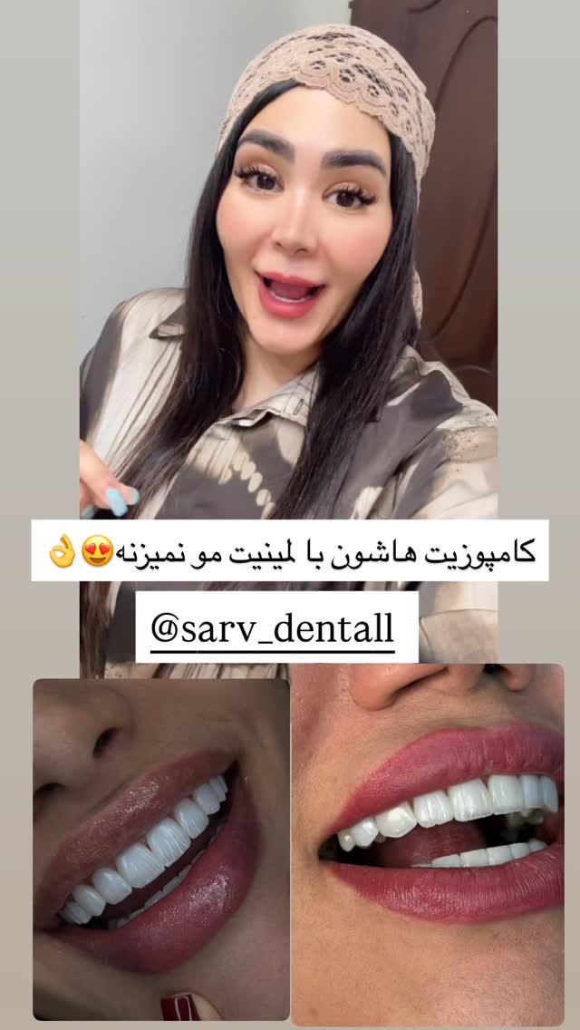  جدید ترین استوری اینستاگرام محی