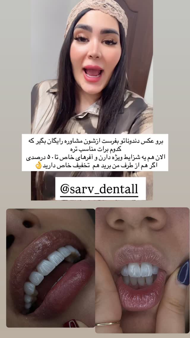  جدید ترین استوری اینستاگرام محی