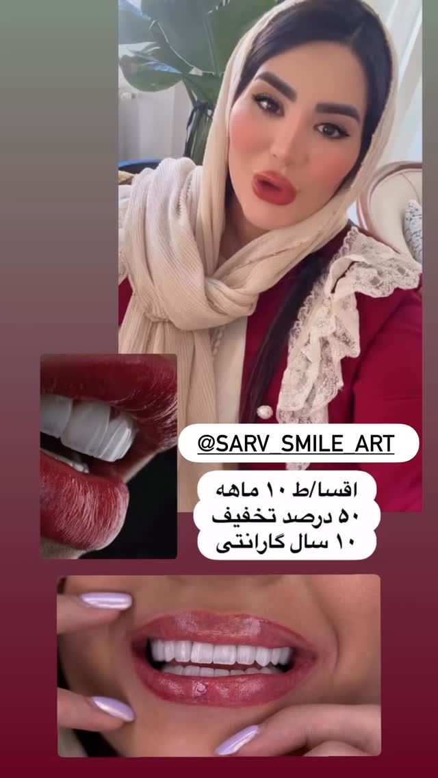  جدید ترین استوری اینستاگرام محی