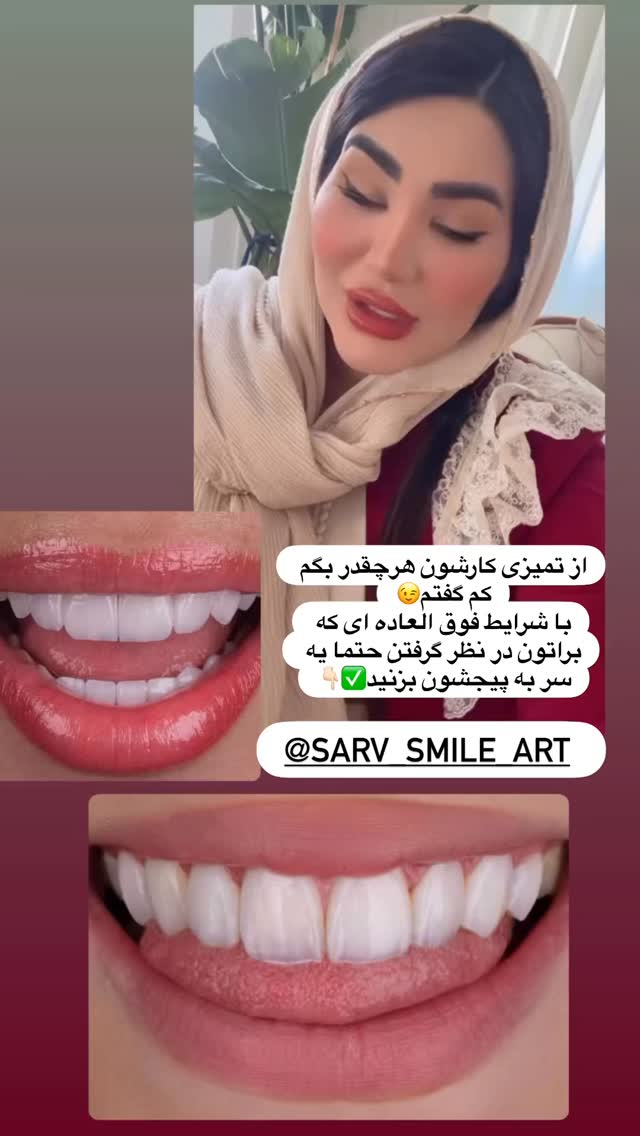  جدید ترین استوری اینستاگرام محی
