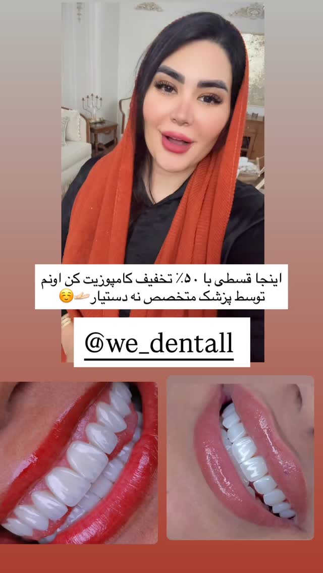  جدید ترین استوری اینستاگرام محی