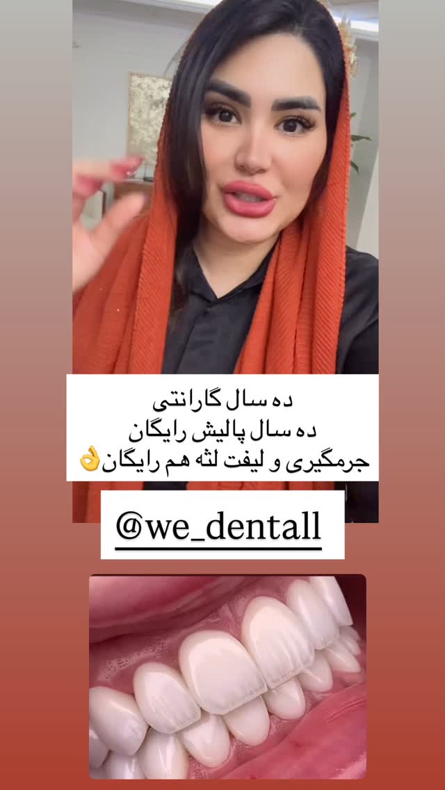  جدید ترین استوری اینستاگرام محی