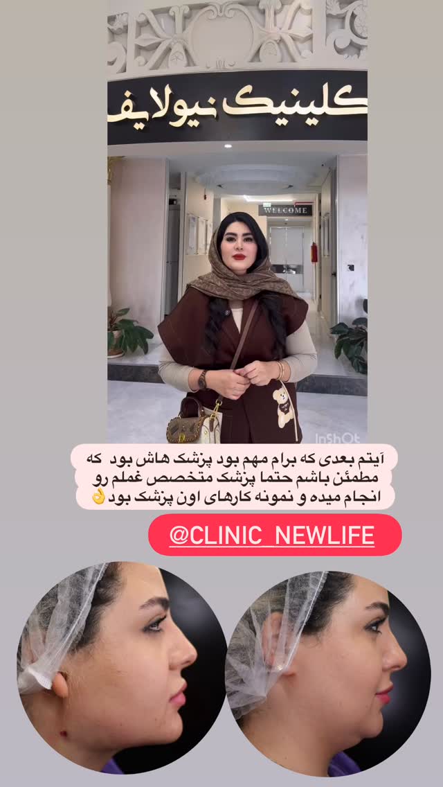  جدید ترین استوری اینستاگرام محی