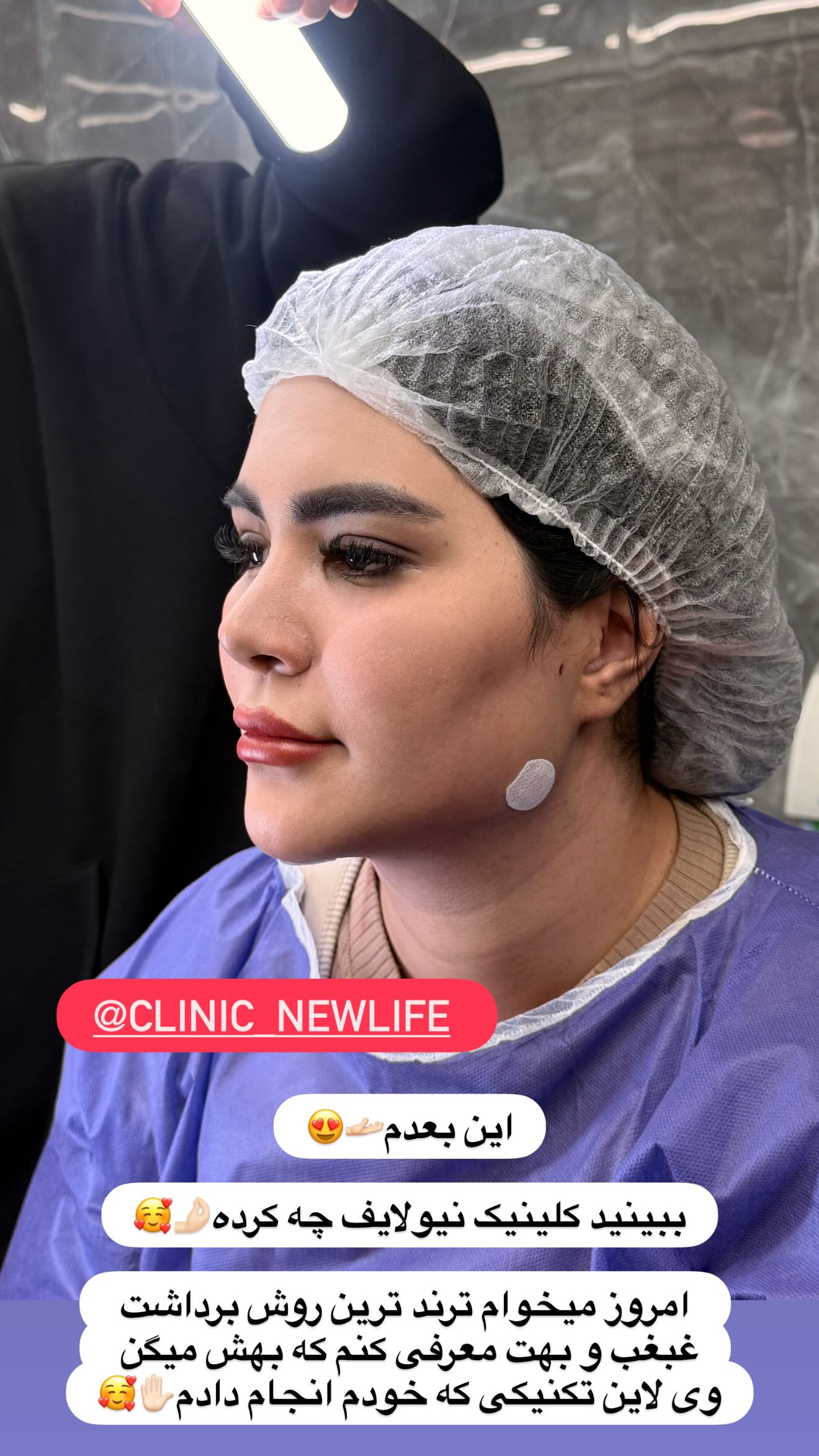  جدید ترین استوری اینستاگرام محی