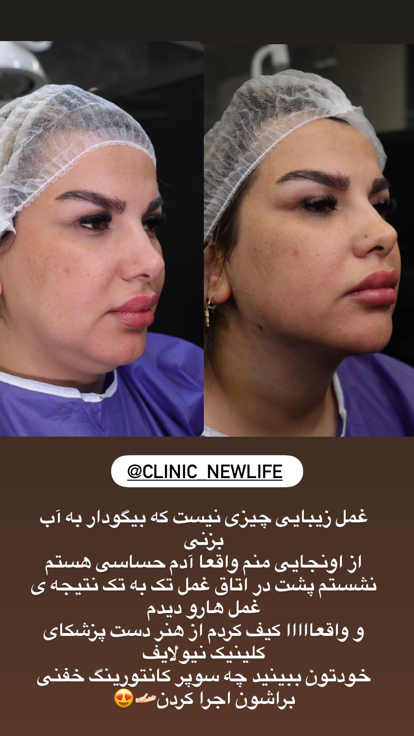  جدید ترین استوری اینستاگرام محی
