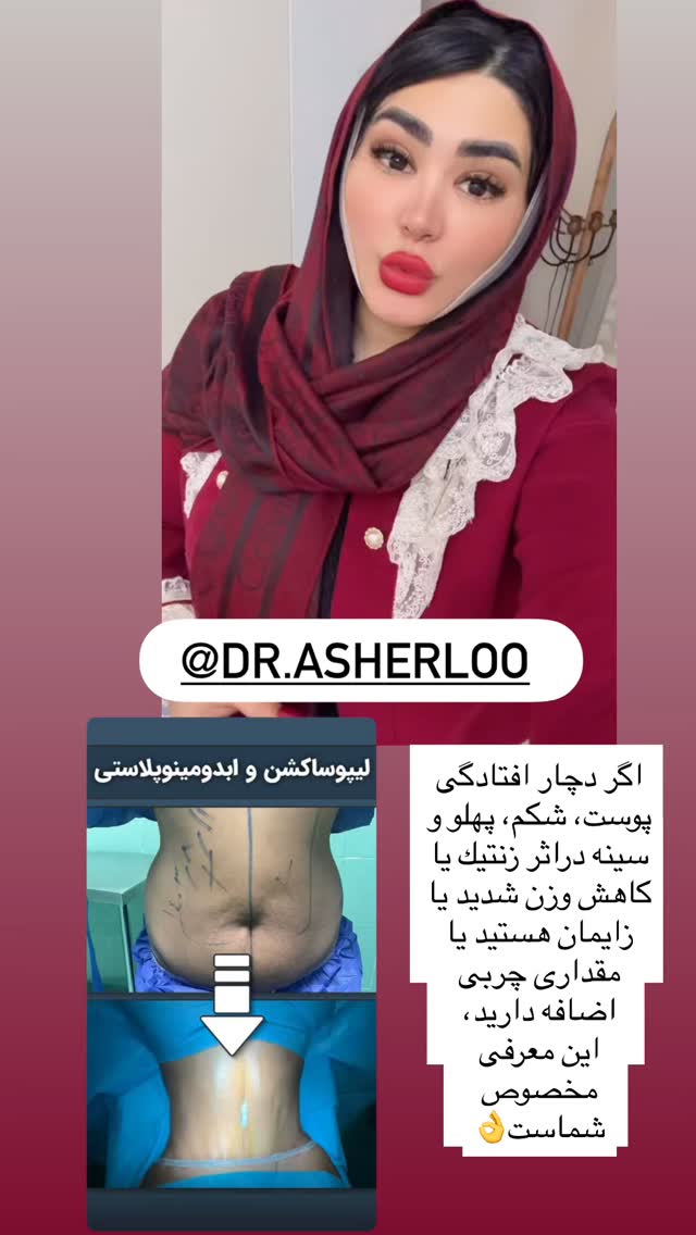  جدید ترین استوری اینستاگرام محی