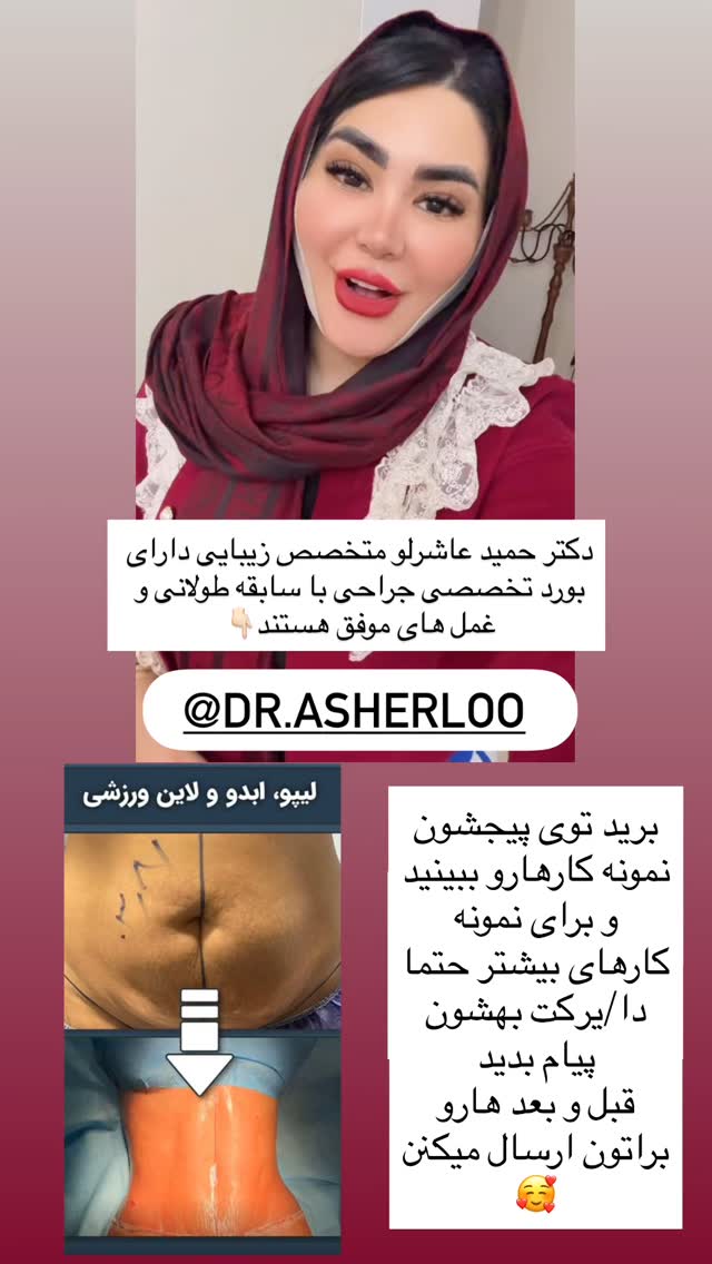  جدید ترین استوری اینستاگرام محی