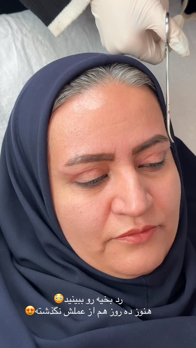  جدید ترین استوری اینستاگرام محی