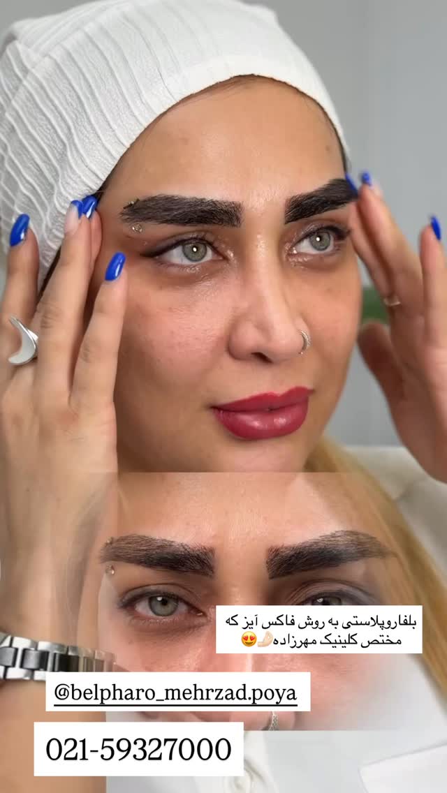  جدید ترین استوری اینستاگرام محی