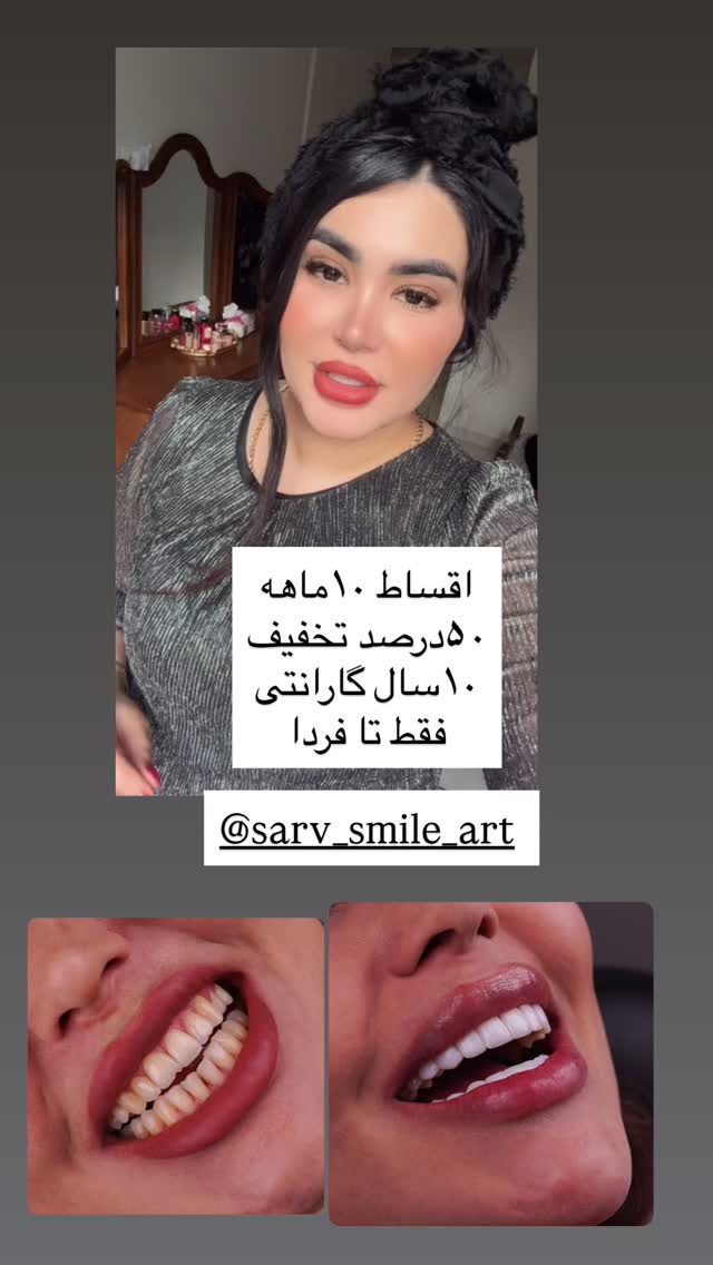  جدید ترین استوری اینستاگرام محی