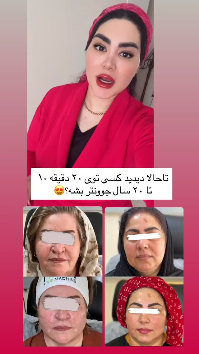  جدید ترین استوری اینستاگرام محی