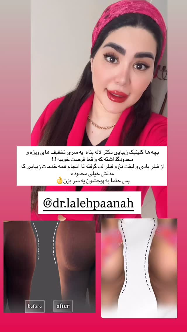  جدید ترین استوری اینستاگرام محی