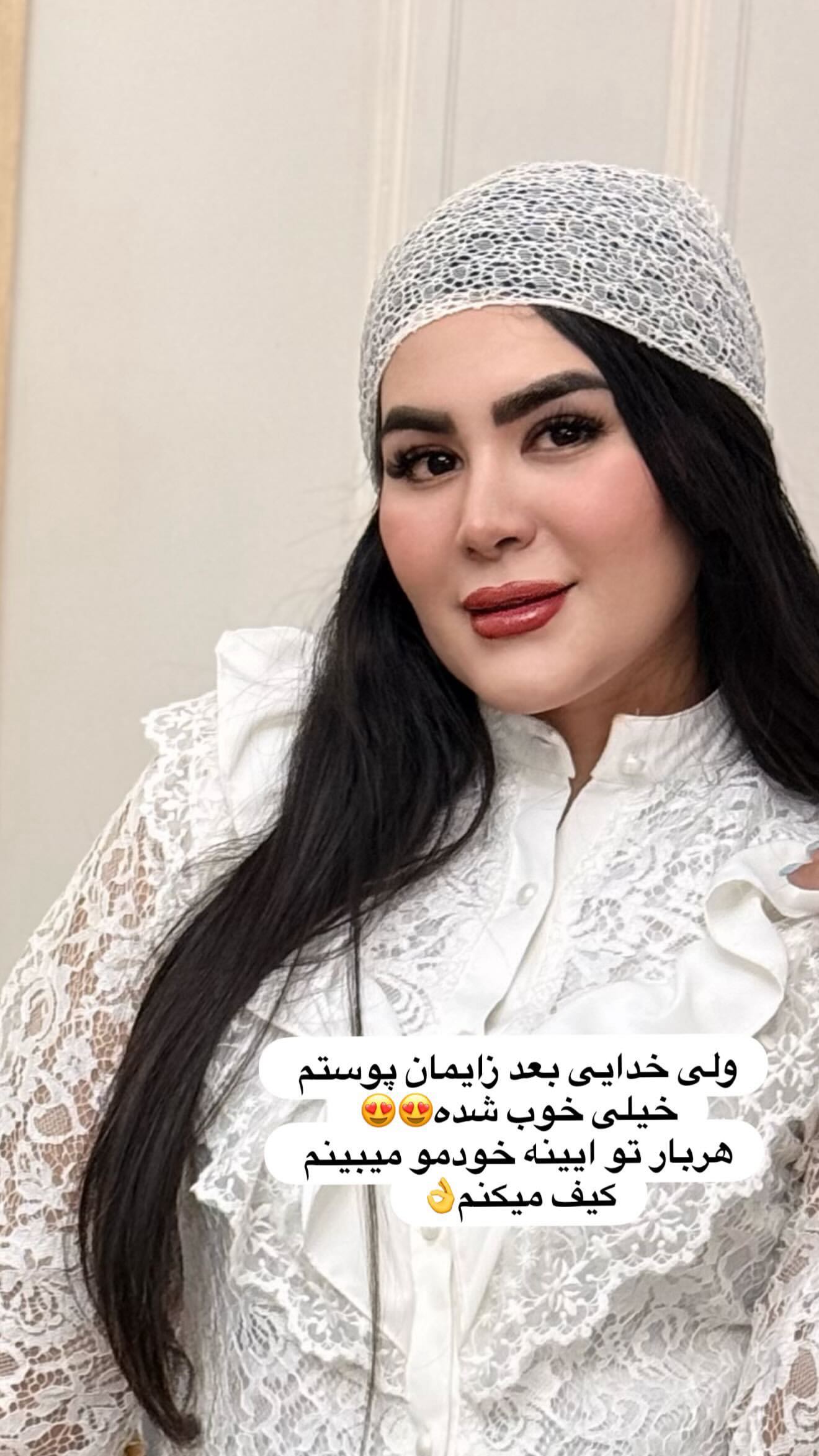  جدید ترین استوری اینستاگرام محی