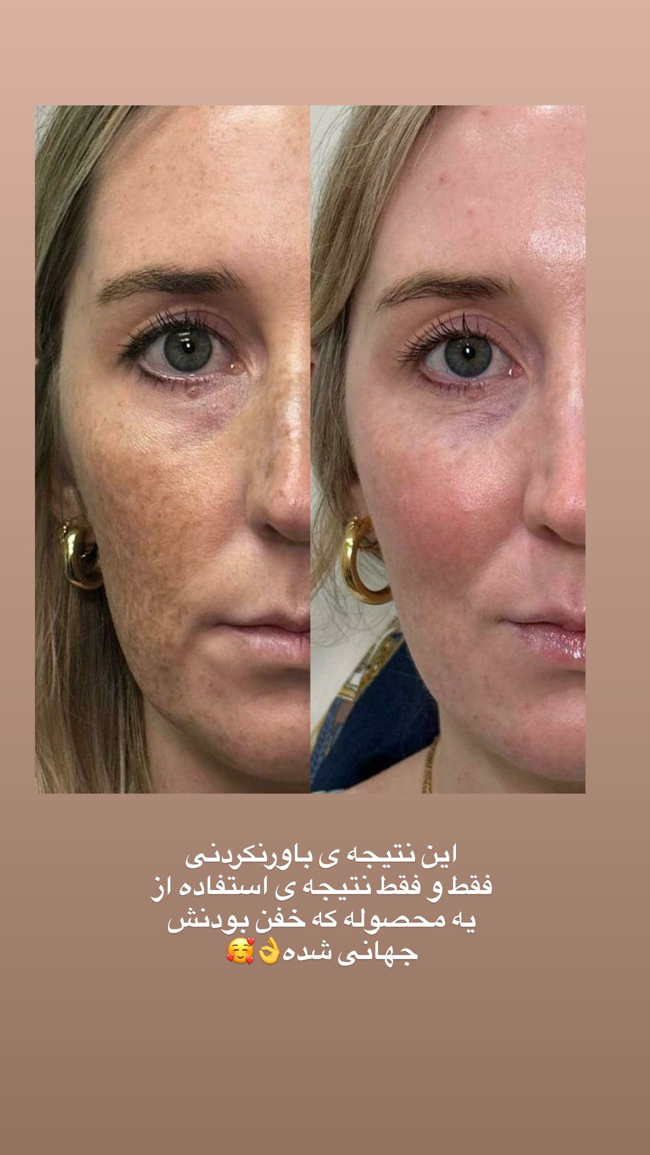  جدید ترین استوری اینستاگرام محی