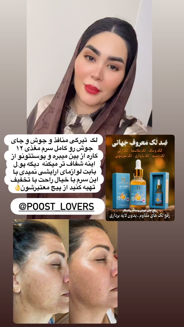  جدید ترین استوری اینستاگرام محی